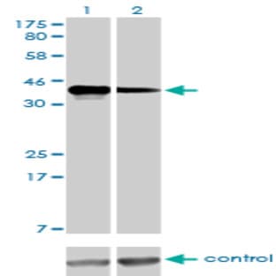 anti-Cyclin K (CCNK) (AA 1-355) antibody avatar