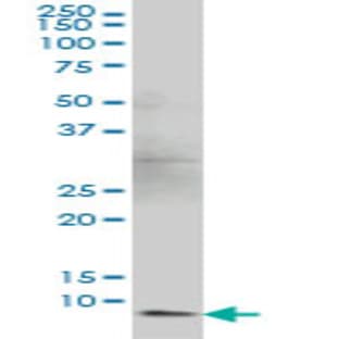 anti-Barrier To Autointegration Factor 1 (BANF1) (AA 1-90) antibody