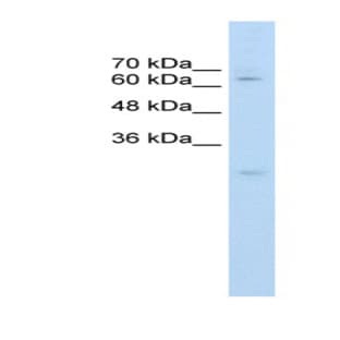 anti-CES2 (C-Term) antibody