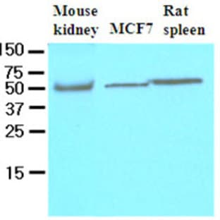 anti-CASP8 and FADD-Like Apoptosis Regulator (CFLAR) (AA 1-376), (N-Term) antibody avatar