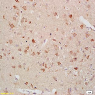 anti-Cholecystokinin B Receptor (CCKBR) antibody avatar