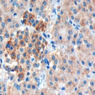anti-Cholecystokinin B Receptor (CCKBR) (Internal Region) antibody avatar