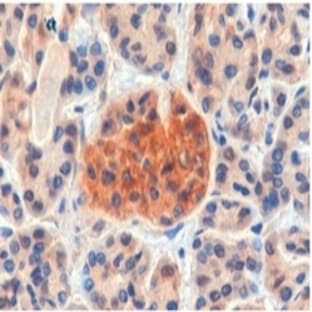 anti-Cholecystokinin B Receptor (CCKBR) (Internal Region) antibody avatar