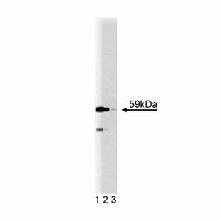 anti-NEDD8 Activating Enzyme E1 Subunit 1 (NAE1) (AA 348-464) antibody