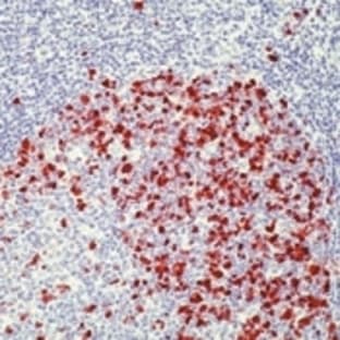 anti-Cyclin A2 (CCNA2) (N-Term) antibody avatar