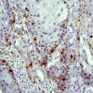 anti-Cyclin A2 (CCNA2) (N-Term) antibody avatar