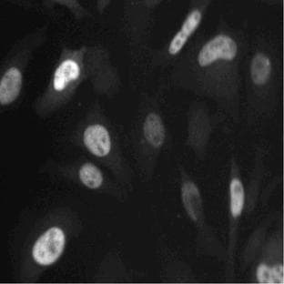 anti-Cyclin A2 (CCNA2) (AA 26-144) antibody avatar