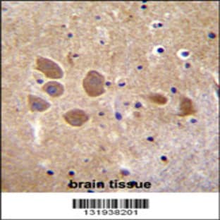 anti-Adaptor-Related Protein Complex 1, mu 1 Subunit (AP1M1) (AA 199-227), (Center) antibody avatar