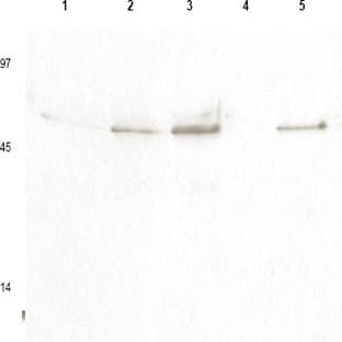 anti-Cyclin B1 (CCNB1) (AA 120-131), (pSer126) antibody avatar