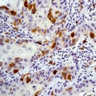 anti-Cyclin B1 (CCNB1) (C-Term) antibody avatar