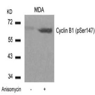 anti-Cyclin B1 (CCNB1) (pSer147) antibody avatar