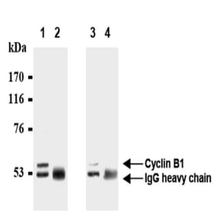 anti-Cyclin B1 (CCNB1) antibody avatar