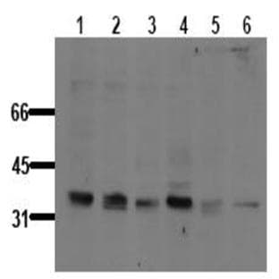 anti-B-Cell CLL/lymphoma 10 (BCL10) (pSer138) antibody avatar