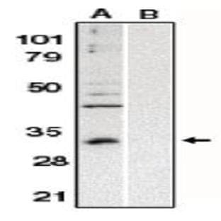 anti-B-Cell CLL/lymphoma 10 (BCL10) (AA 5-19) antibody avatar