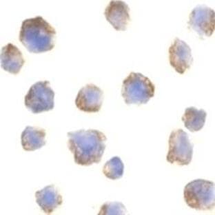 anti-B-Cell CLL/lymphoma 10 (BCL10) (AA 5-19) antibody avatar