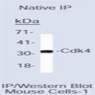 anti-Cyclin D2 (CCND2) antibody avatar