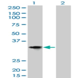 anti-Cyclin D2 (CCND2) (AA 190-289) antibody avatar