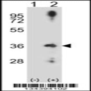 anti-Cyclin D2 (CCND2) (N-Term), (AA 1-30) antibody avatar