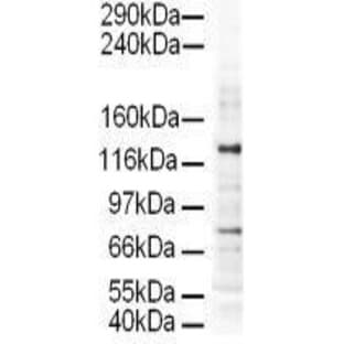 anti-Adaptor-Related Protein Complex 3, delta 1 Subunit (AP3D1) (AA 686-698) antibody avatar