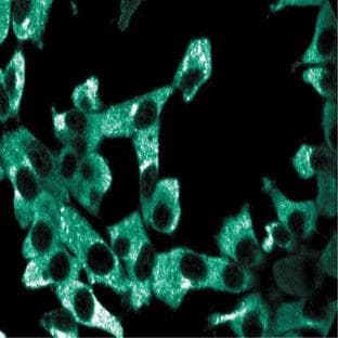 anti-Adaptor-Related Protein Complex 3, delta 1 Subunit (AP3D1) (AA 627-731) antibody avatar