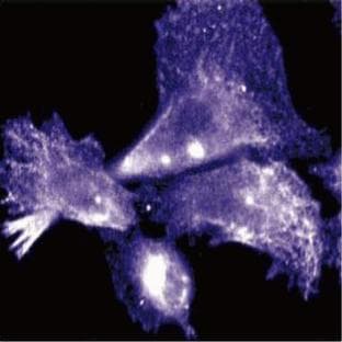 anti-Cyclin D3 (CCND3) (AA 127-292) antibody avatar