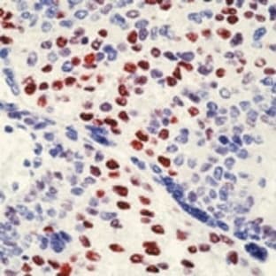 anti-Cyclin E1 (CCNE1) antibody avatar