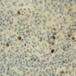 anti-Cyclin E1 (CCNE1) antibody avatar