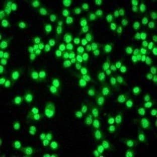 anti-Cyclin E1 (CCNE1) antibody avatar