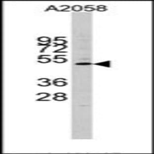 anti-Cyclin E1 (CCNE1) (C-Term) antibody avatar