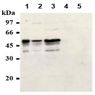 anti-Cyclin E1 (CCNE1) antibody avatar