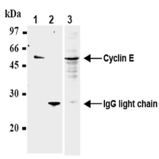 anti-Cyclin E1 (CCNE1) antibody avatar