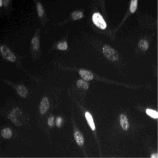 anti-Cyclin E1 (CCNE1) antibody