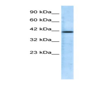 anti-CHRNA7 (Cholinergic Receptor, Nicotinic, alpha 7, Exons 5-10) and FAM7A (Family with Sequence Similarity 7A, Exons A-E) Fusion (CHRFAM7A) (N-Term) antibody avatar