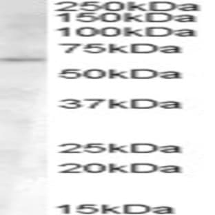 anti-Activin Receptor Type I (ACRV1) (Internal Region) antibody avatar