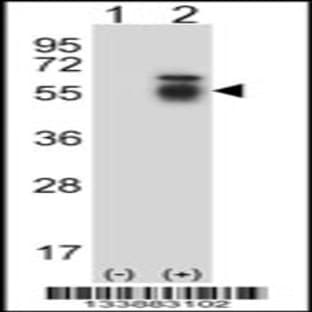anti-Activin Receptor Type I (ACRV1) (AA 132-161), (Center) antibody avatar