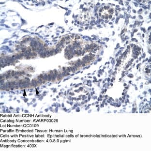 anti-Cyclin H (CCNH) (C-Term) antibody avatar