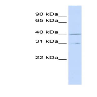 anti-Cyclin H (CCNH) (Middle Region) antibody avatar