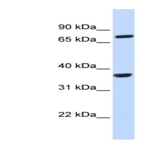 anti-Chemokine (C-C Motif) Receptor-Like 2 (CCRL2) (N-Term) antibody avatar