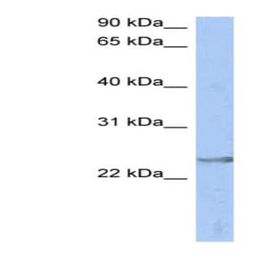 anti-ATPase, H+ Transporting, Lysosomal 31kDa, V1 Subunit E2 (ATP6V1E2) (Middle Region) antibody