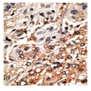 anti-Bcl2 Modifying Factor (BMF) (AA 130-150), (BH3 Domain) antibody avatar