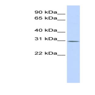 anti-Yip1 Interacting Factor Homolog B (S. Cerevisiae) (YIF1B) (Middle Region) antibody