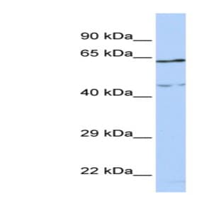 anti-Coiled-Coil Domain Containing 74A (CCDC74A) (Middle Region) antibody avatar