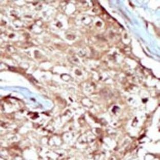 anti-3'-phosphoadenosine 5'-phosphosulfate Synthase 2 (PAPSS2) (C-Term) antibody avatar