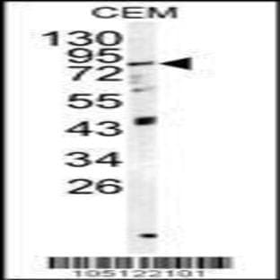 anti-3'-phosphoadenosine 5'-phosphosulfate Synthase 1 (PAPSS1) (N-Term), (Lys9), (AA 1-30) antibody avatar