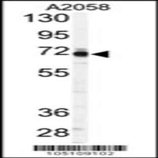 anti-3'-phosphoadenosine 5'-phosphosulfate Synthase 1 (PAPSS1) (C-Term), (AA 592-624) antibody avatar