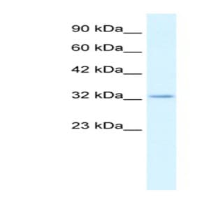 anti-Claudin 10 (CLDN10) (C-Term) antibody avatar