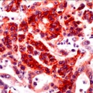 anti-Claudin 2 (CLDN2) (C-Term) antibody avatar