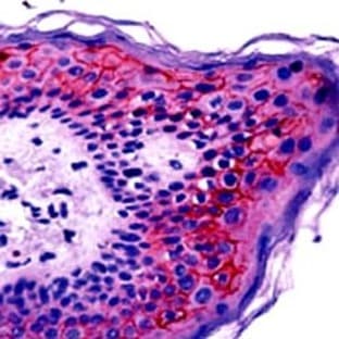 anti-Claudin 1 (CLDN1) (C-Term) antibody avatar