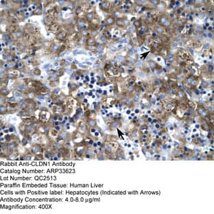 anti-Claudin 1 (CLDN1) (C-Term) antibody avatar