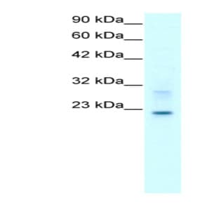 anti-Claudin 9 (CLDN9) (C-Term) antibody avatar